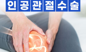 인공관절수술, 언제하면 좋을까요? - 새동산병원 인공관절센터