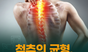 🦴 척추가 휘는 척추측만증, 조기 발견이 중요합니다!