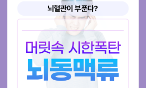 뇌혈관이 보내는 위험 신호, 뇌동맥류! 조기 발견이 중요한 이유